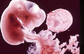 embrione 7 settimane