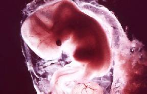 embrione 8 settimane