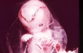 embrione 10 settimane