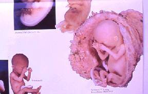 feto 12 settimane